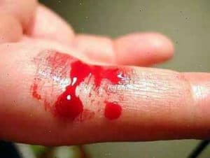 no coagular la sangre